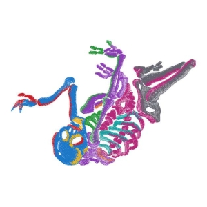 骷髅